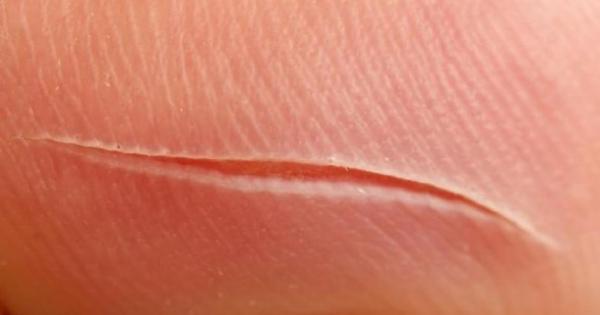 Всеки има белег който би искал да изчезне Няма значение дали