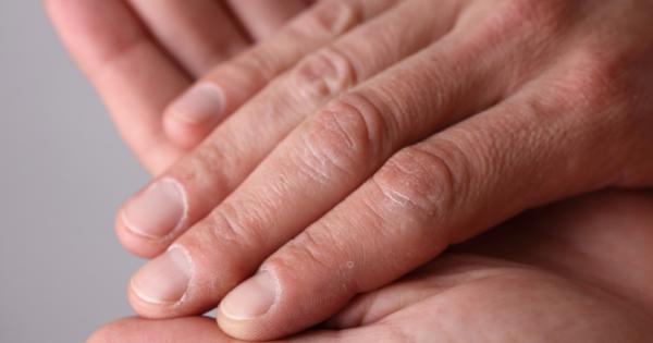 Хората със суха кожа знаят че през зимата положението се