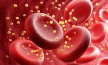 По-ниският LDL холестерол е свързан с по-висок риск от диабет тип 2 независимо от употребата на статини