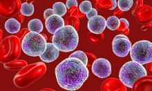 Създадоха наночастици, които унищожават ракови клетки, без да засягат здравите