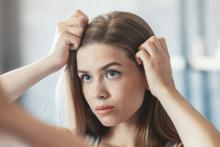 Косопадът при жените – как да се справим?