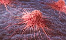 Популярна добавка против стареене може да подпомага растежа на рак