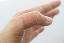 Създадоха прах, който мигновено запечатва рани и спира кървенето